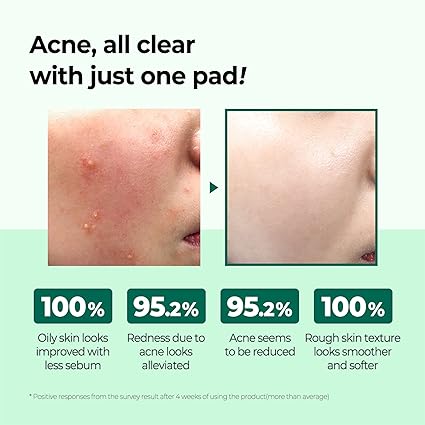 Pad-uri cu AHA BHA PHA, 30 Days Miracle, Some by Mi, 70 buc