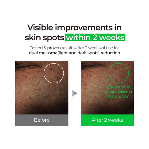 Ser revitalizant pentru ingrijirea pielii cu Vitamina C si extract de Lamaie, Niacinamide si Alpha-Bisabolol, Lemon CNA, IZEZE, 30 ml