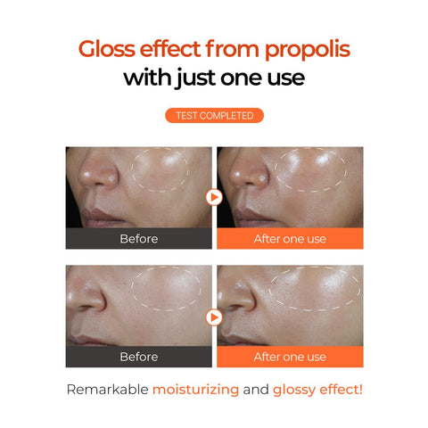 Ser revitalizant pentru ingrijirea pielii cu extract de Propolis si Niacinamide, IZEZE, 30 ml